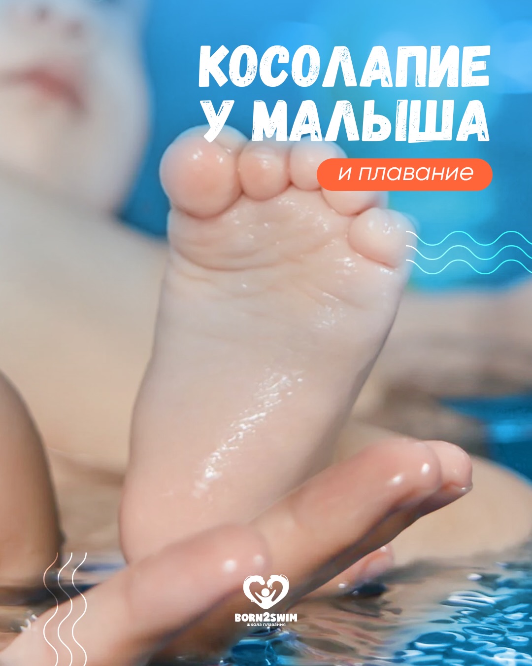 Косолапие у малыша